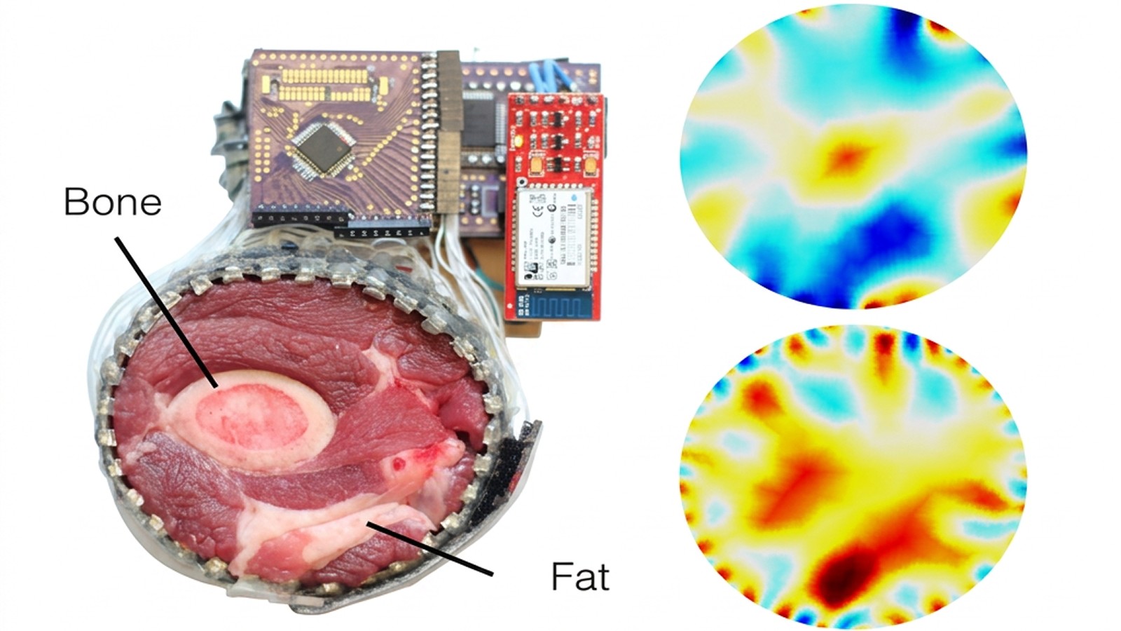 A circumferential EIT band wrapped around a cross-section of tissue with bone and fat labelled, wired to stacked circuit boards; beside it, two circular impedance maps reconstructed from the band's measurements.